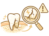 Травма или перелом под десной